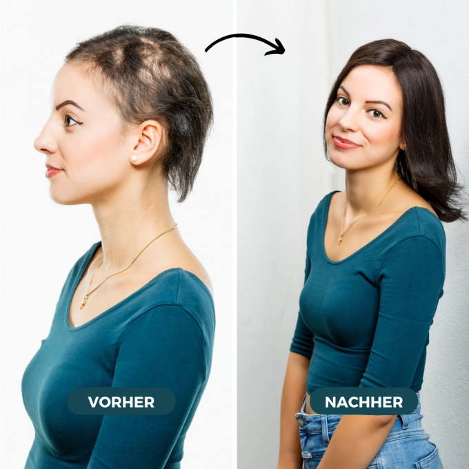 Endlich dichtes Haar mit Tritec-Hair