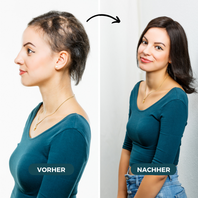 Endlich dichtes Haar mit Tritec-Hair